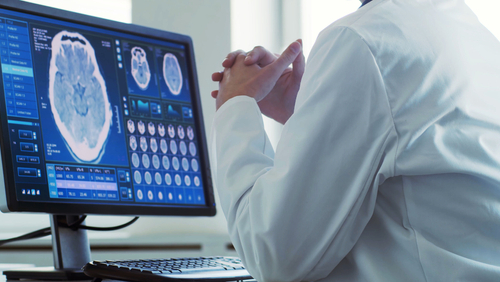 Doamna Larisa SOLTAN, medicul neurolog